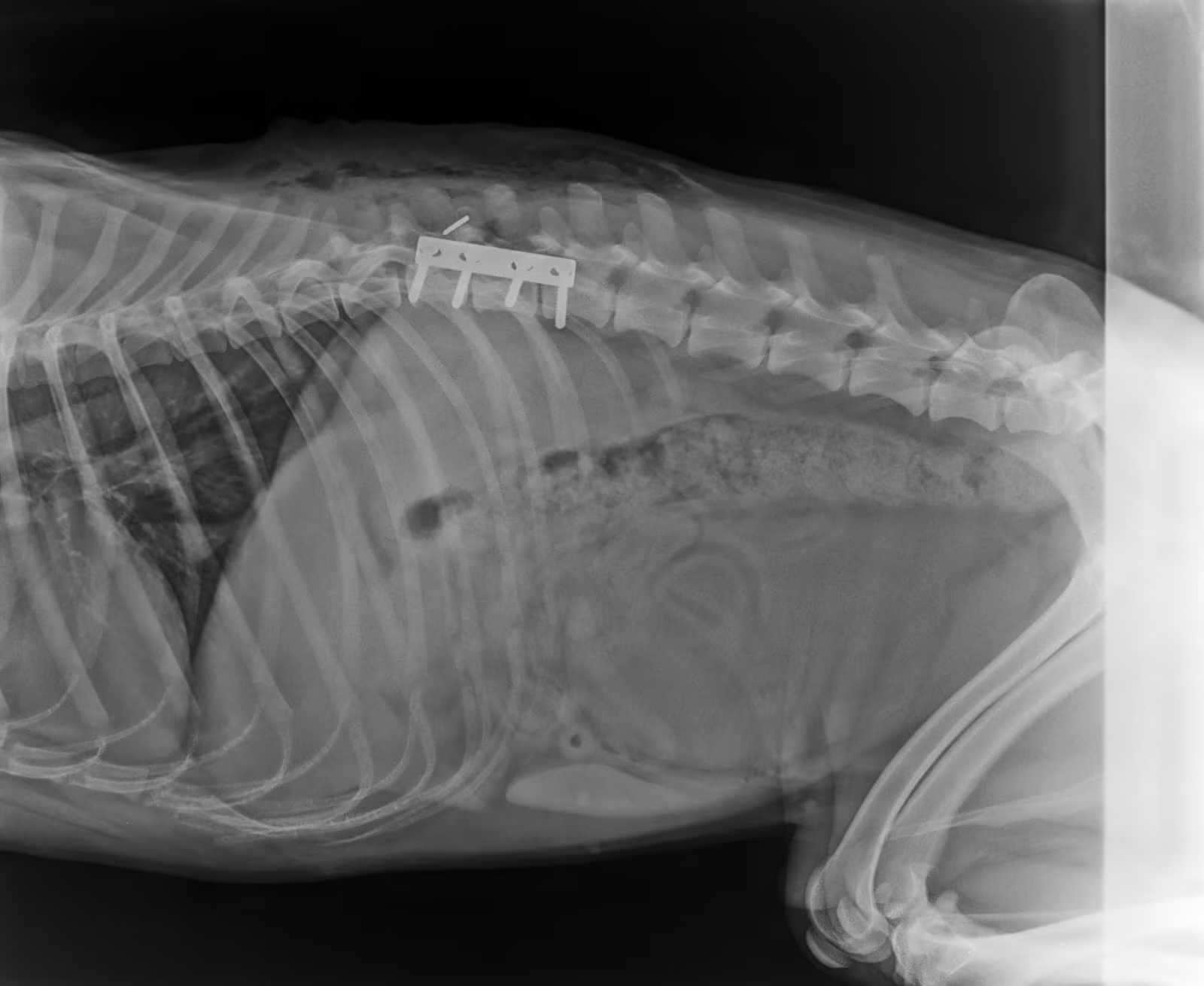 Röntgenbild: Hope nach der OP